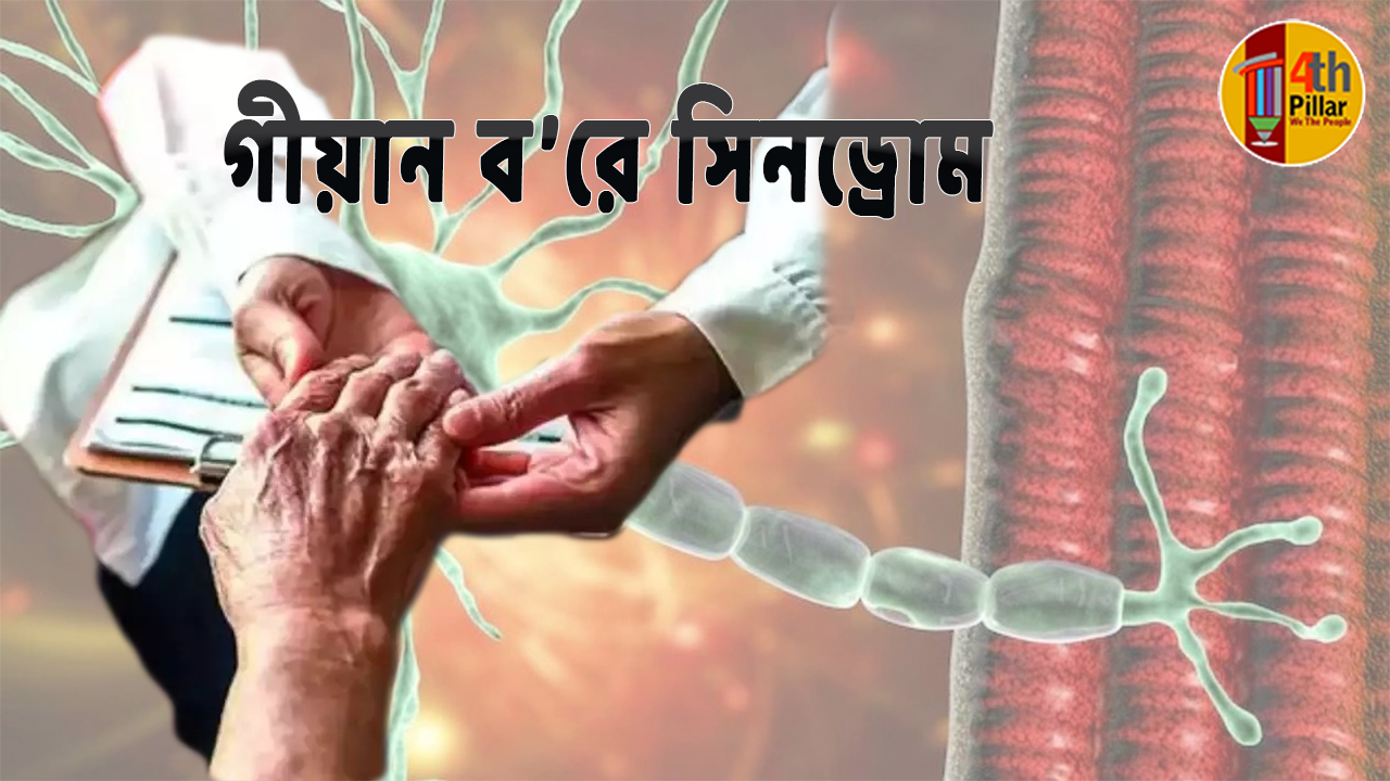 গীয়ান ব’রে সিনড্রোম (GB Syndrome) নিয়ে কিছু কথা
